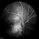 retinagallery_281129.jpg