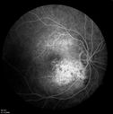 retinagallery_281229.jpg