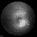 retinagallery_281529.jpg