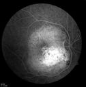 retinagallery_281729.jpg