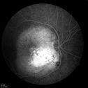 retinagallery_281929.jpg