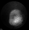 retinagallery_282229.jpg