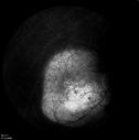 retinagallery_282629.jpg