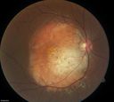 retinagallery_283029.jpg