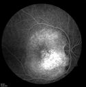 retinagallery_284229.jpg