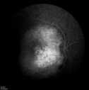retinagallery_285229.jpg