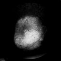 retinagallery_285929.jpg