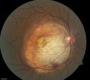retinagallery_286429.jpg
