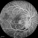 retinagallery_287529.jpg