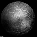 retinagallery_28929.jpg