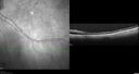 srfluid_pason_042318_07.jpg