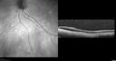 srfluid_pason_042318_09.jpg