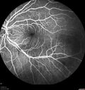 srfluid_pason_042318_17.jpg
