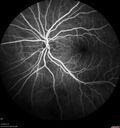 srfluid_pason_042318_18.jpg