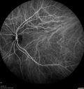 srfluid_pason_042318_28.jpg