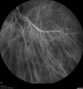 srfluid_pason_042318_29.jpg