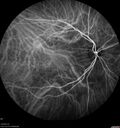 srfluid_pason_042318_32.jpg